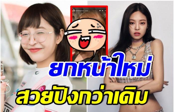 Open the latest photo of Kwang Deerlong after surgery to make her look like Jenny Blackpink